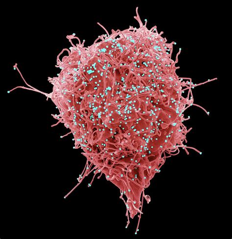 Hiv Infected Cell Photograph By Steve Gschmeissnerscience Photo