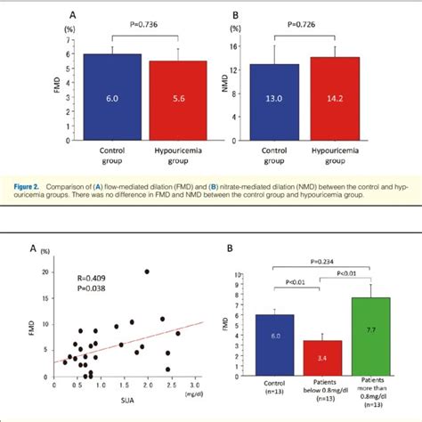 A Positive Correlation Between Serum Uric Acid Sua And