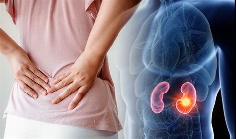 Lower Back Pain The Signs Your Back Pain Could Be Caused Be Kidney