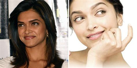 8 Bollywood Divas Who Went For Skin Whitening Treatment