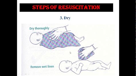 Neonatal Resuscitation Images