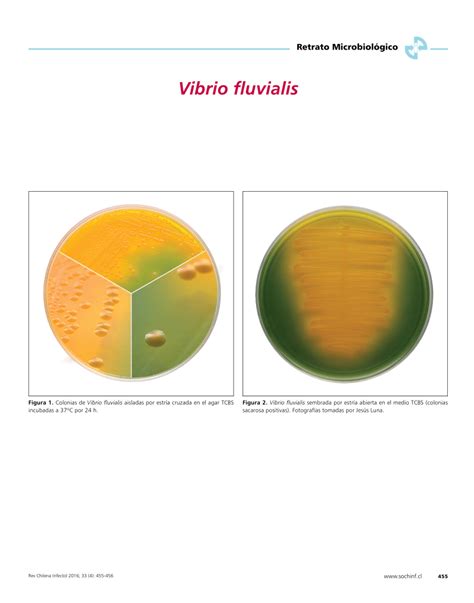 (PDF) Vibrio fluvialis