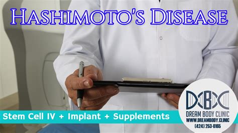 Hashimotos Disease Stem Cell Treatment Dreambody Clinic