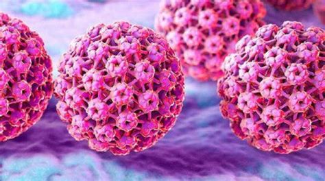 Virus del Papiloma Humano VPH Qué es Causas y Síntomas