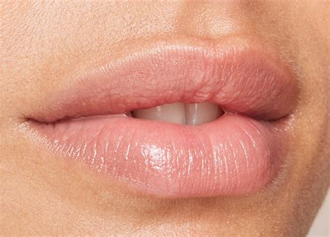 How To Make Your Lip Filler Results Last Longer Lip Fillers How To