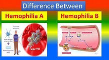 Difference Between Hemophilia A and Hemophilia B - YouTube