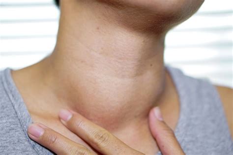 What Are Thyroid Cystseverything One Should Know To Be Safe