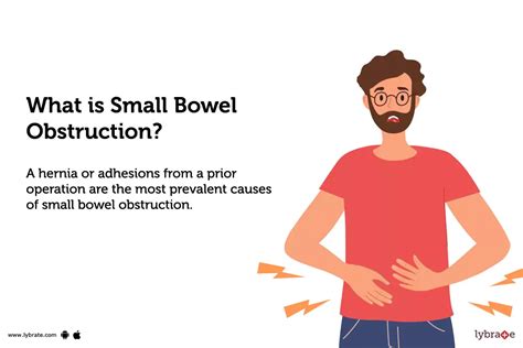 Small Bowel Obstruction Causes Symptoms Treatment And Cost