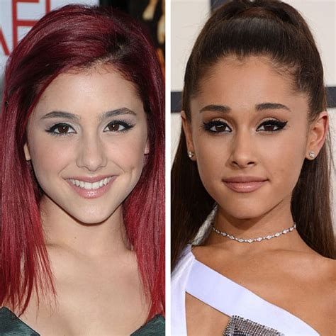 Ariana Grande Plastic Surgery Transformation