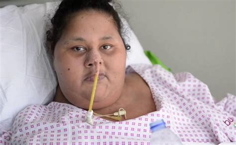 Worlds Heaviest Woman Eman Ahmed Dies At 36 Indiablooms First