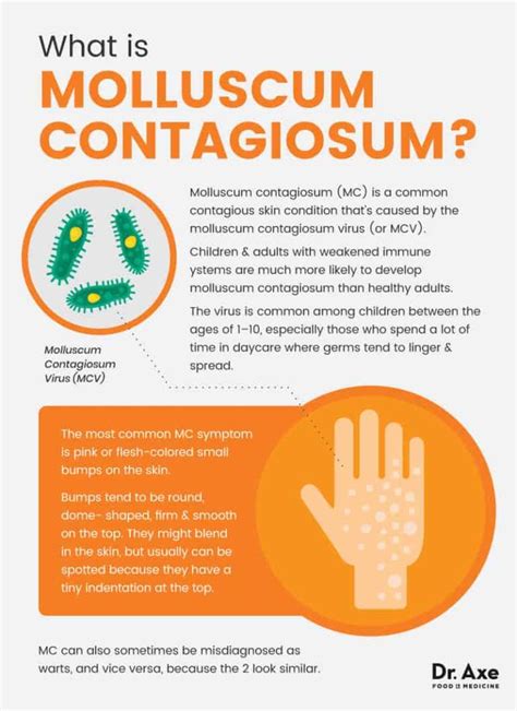 Molluscum Contagiosum Natural Easy Ways To Help Treat It Dr Axe