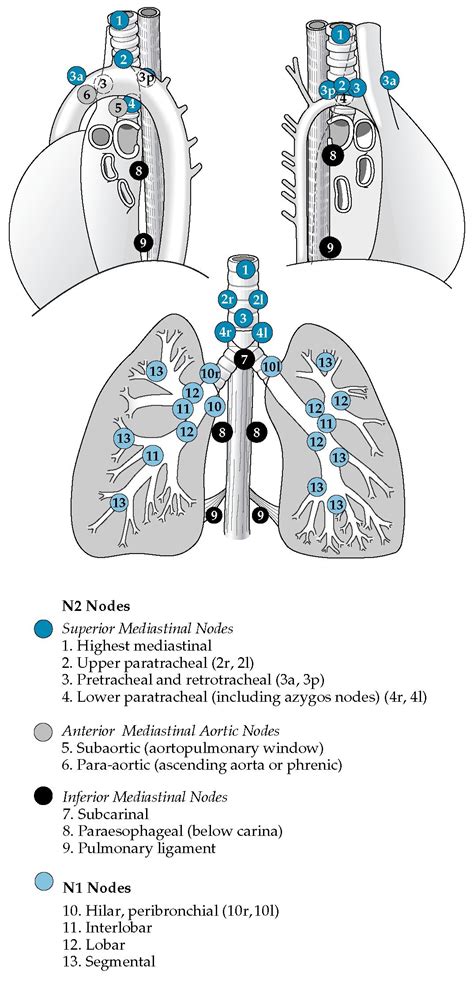 Lung Cancer Part 3