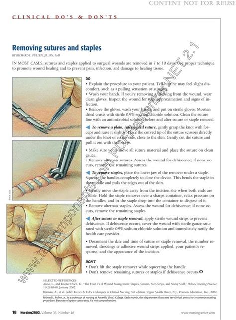 Removing Sutures And Staples Nursing2016 Sutures Wound Healing