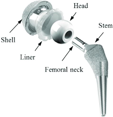 Main Components Of An Artificial Hip Joint 2 Download Scientific