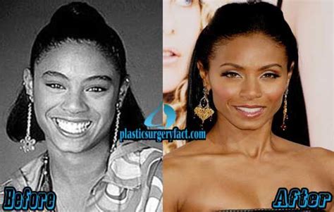 Jada Pinkett Smith Plastic Surgery Before And After Photos Jada