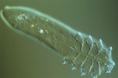 What Are Face Mites Demodex Folliculorum Know Its Causes And Treatment