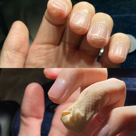 When You Cut Your Nails Too Short And Got A Nail Split When Practicing