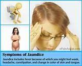 Jaundice Home Remedies For Adults