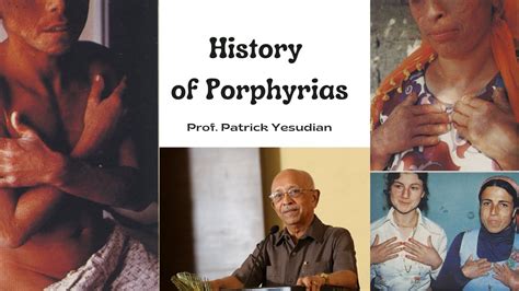 History Of Porphyrias Youtube