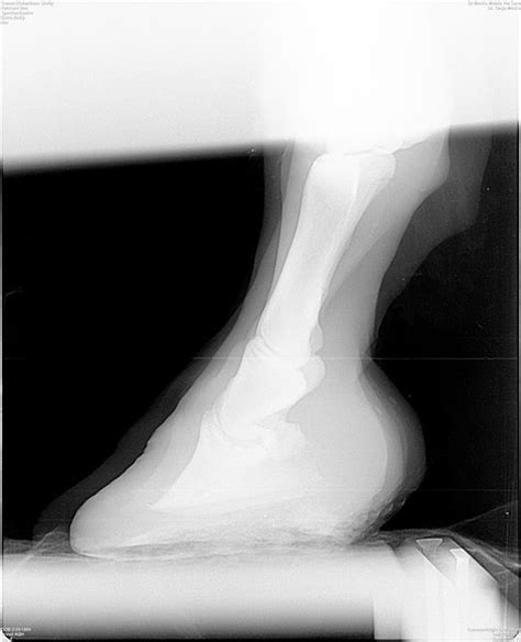 Radiograph Of An Equine Front Hoof With Coffin Bone Rotation From