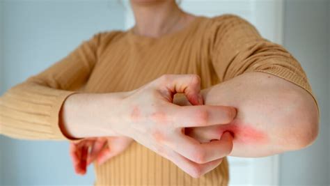 10 Signs When To Worry About A Rash