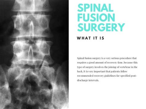Recovering From Spinal Fusion Surgery