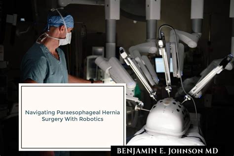 Navigating Paraesophageal Hernia Surgery With Robotics