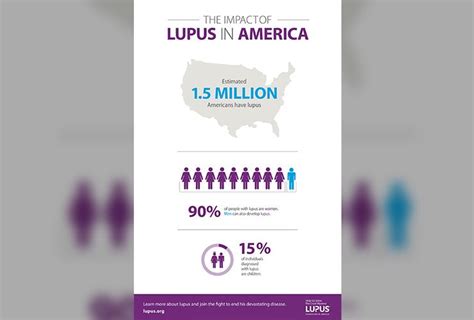 The 10 Symptoms That Mean You May Have Lupus Lifedaily