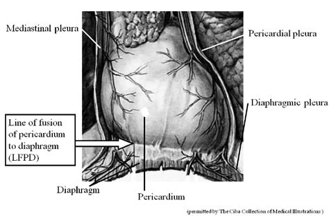The Anatomy Of The Line Of Fusion Of Pericardium To Diaphragm Lfpd