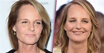 Helen Hunt Erased Her Wrinkles at Age 56: How Did She Do It? - Verge Campus
