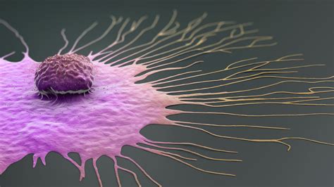 Crispr Technique Effectively Destroys Metastatic Cancer Cells In Living