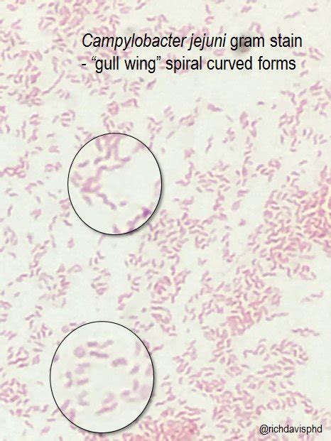 Campylobacter Jejuni On Microscopy Gull Wing Spiral Grepmed