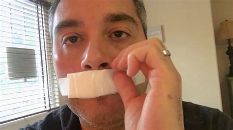 Septoplasty And Turbinate Reduction Surgery Days 1 And 2 Youtube