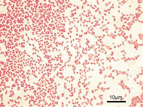 Figure Microscopic Image Of Gram Negative Pseudomonas