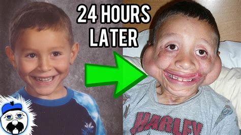 15 Kids Who Survived The Impossible Youtube