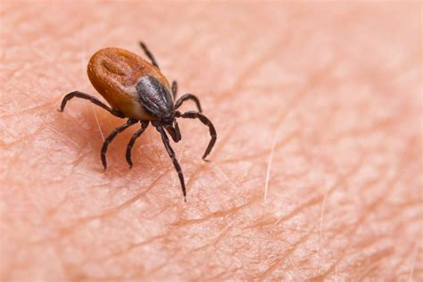 Urgent Warning As Lyme Disease Cases Rising In Ireland And Record Number