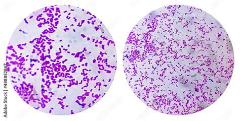 Photo Collage Of Two Microscopic Image Of Escherichia Coli Bacterium E