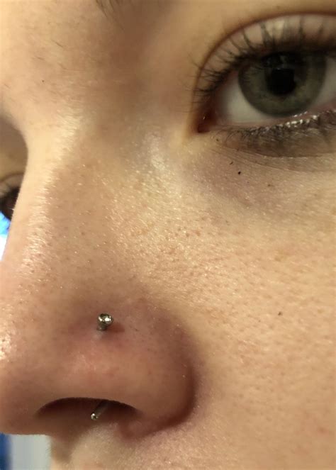 Help Nose Piercing I Noticed Im Getting This Little Bump Where My