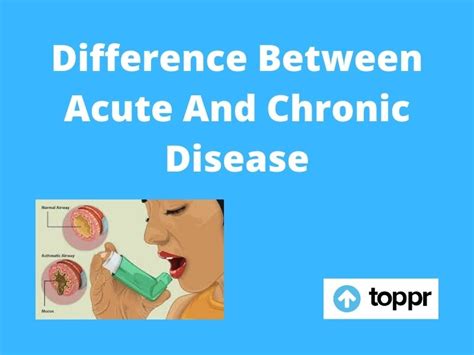 What Is Acute Disease Acute Diseases Diseases Club Center