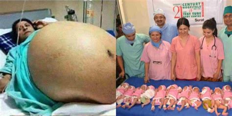 Rekor Dunia Kehamilan Kembar Dengan Jumlah Terbanyak Yaitu Janin