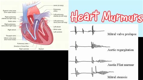 heart murmur 3540 hot sex picture