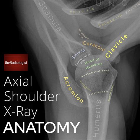 Labeled Axial Shoulder X Ray Anatomy By Dr Naveen Grepmed