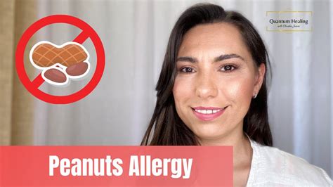 Peanuts Allergy Why We Have Peanuts Allergy Youtube