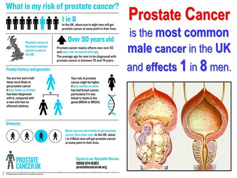 Prostate Cancer FULL HEALTH SECRETS