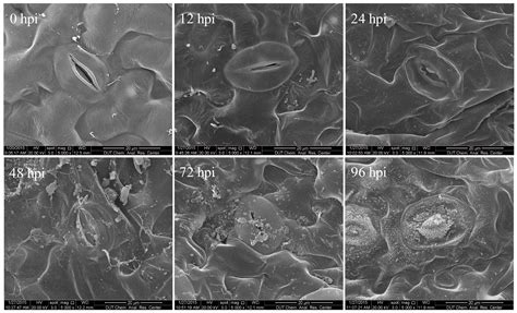 The conidial anastomosis tubes are morphologically and physiologically distinct from germ tubes. IJMS | Free Full-Text | Transcriptome Analysis of Tomato ...