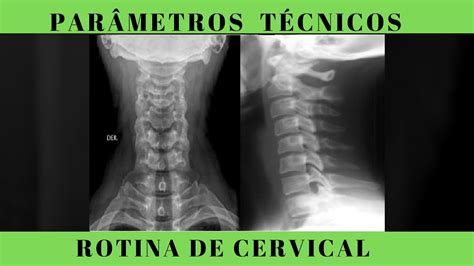 Rotina De Coluna Cervical Avaliação Dos Padrões Técnicos Anatomia