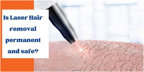 Is Laser Hair Removal Permanent And Safe Avens Blog Avens Blog