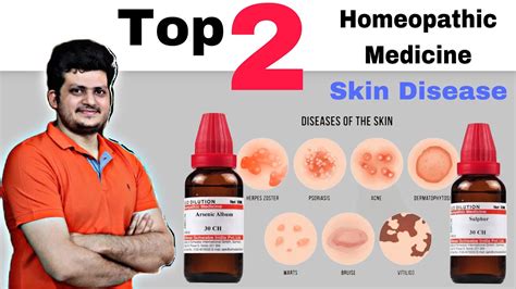 Top 2 Homeopathic Medicine For Skin चर्म रोग की सबसे बेहतरीन दो
