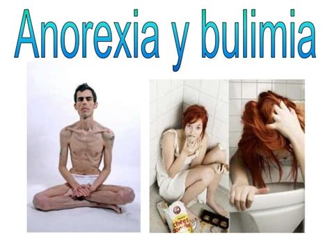 Trastornos De Alimentación En Adolescentes Anorexia Y Bulimia E7d