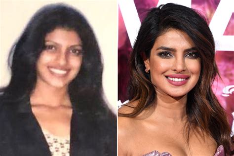 Priyanka Chopra S Before And After Evolution Through The Years